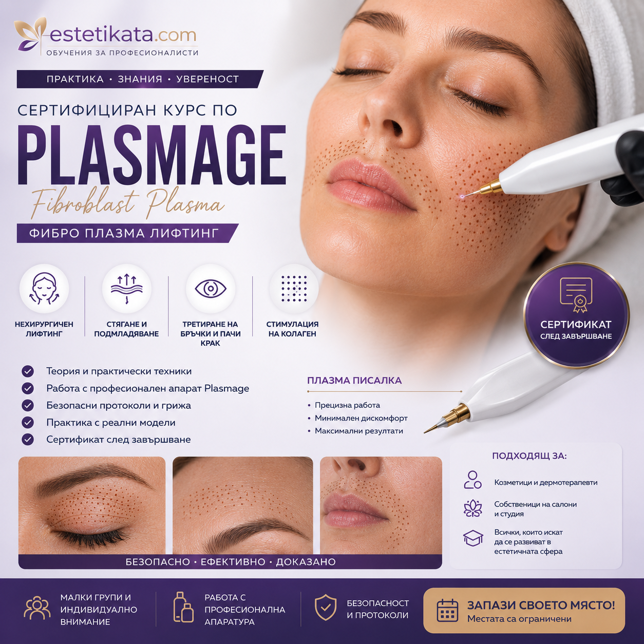 Сертифициран курс по PLASMAGE (Fibroblast Plasma) Фибро Плазмa Лифтинг Пен