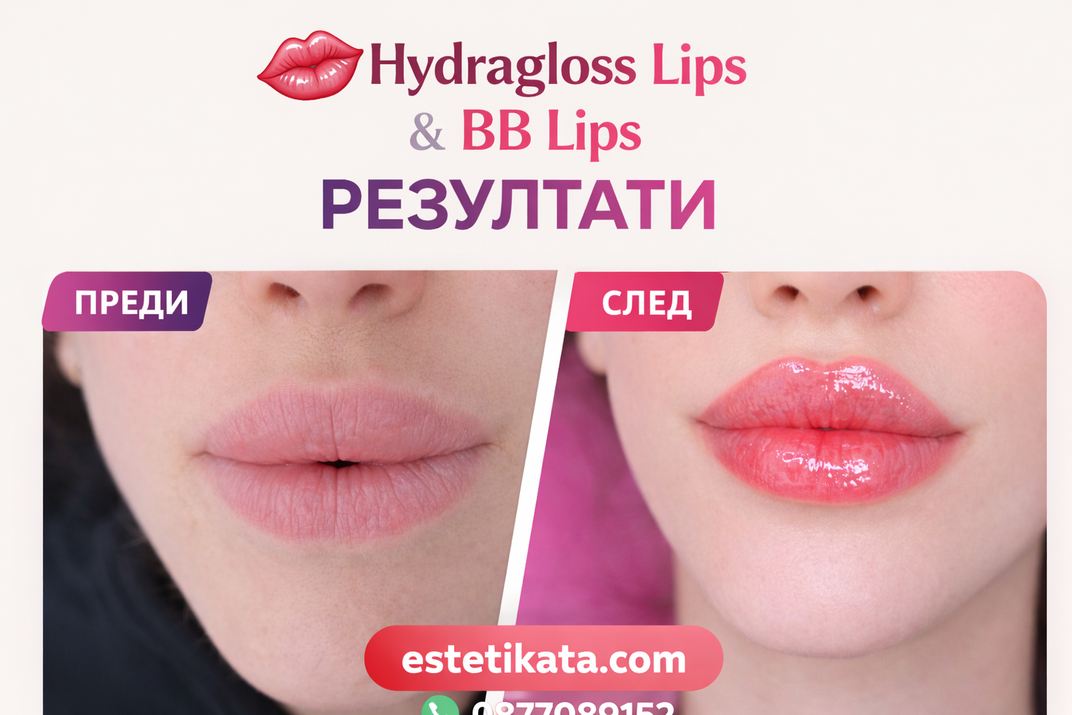 💄💋 Hydragloss Lips & BB Lips – обучение с ЦВЯТ, не просто блясък! - Image 4