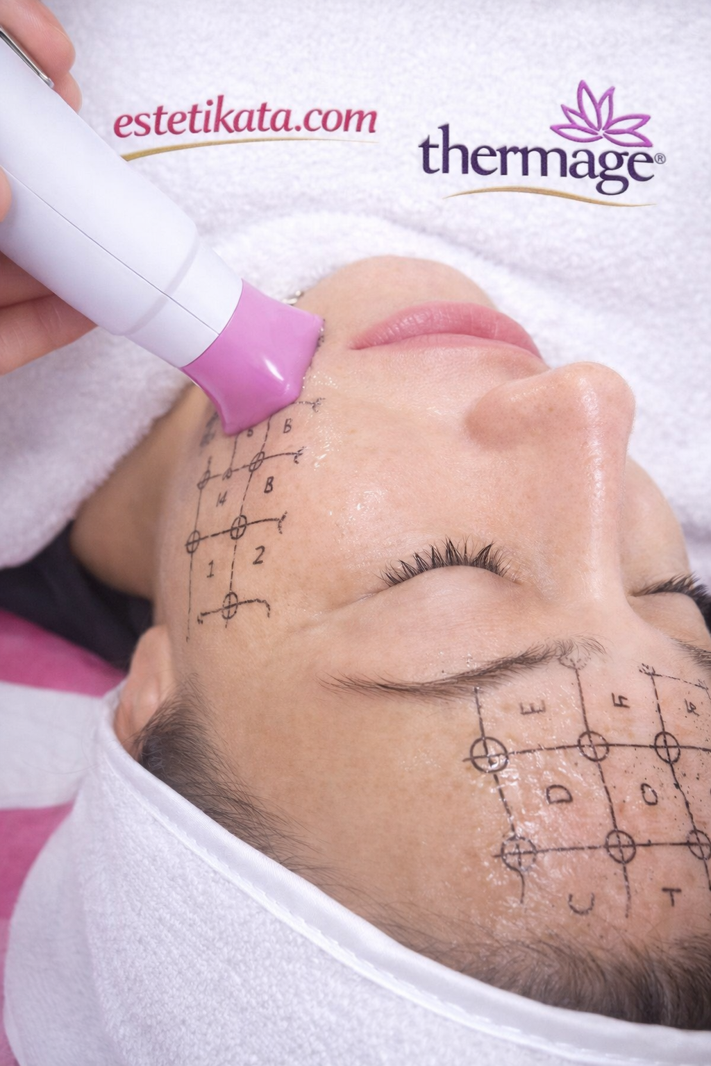 Thermage FLX – Неинвазивен лифтинг и подмладяване на лице и тяло