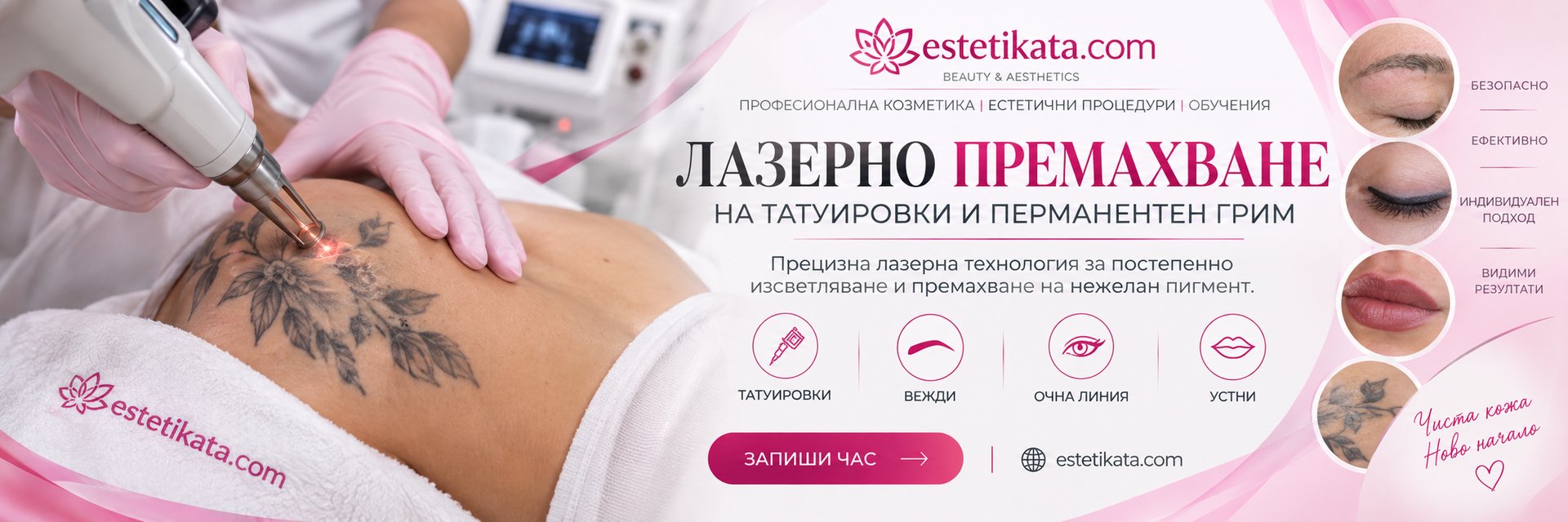 Лазерно премахване на татуировки